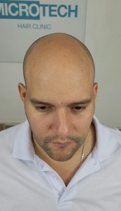 capilar