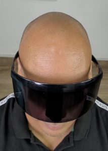 micropigmentación