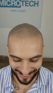 relleno óptico de cabello