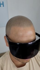 simular cabello rapado