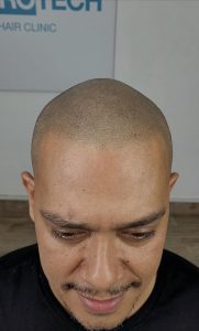 tratamiento estético capilar